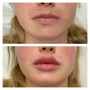 Доктор Лазер, Moscow Фото - 7