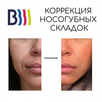 Волна, Moscow Фото - 5