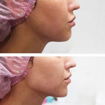 Жемчуг, Moscow Фото - 5