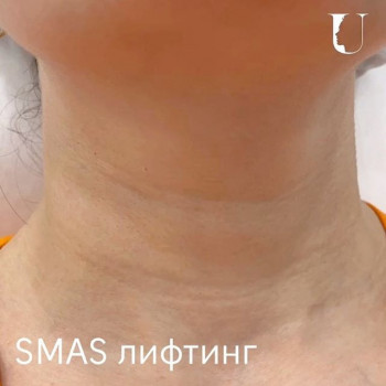 Елена Умнова, Moscow Фото - 6