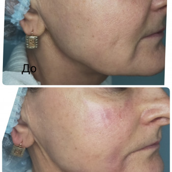 Елена Козырева, Moscow Фото - 5