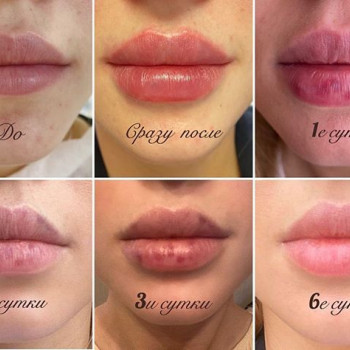 Валерия , Moscow Фото - 6