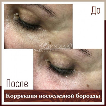 Елена Ковтунова, Moscow Фото - 5