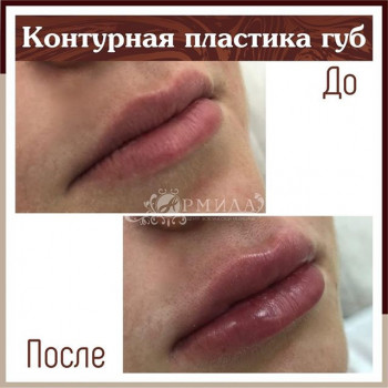 Елена Ковтунова, Moscow Фото - 6