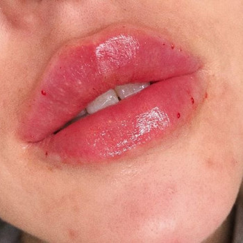 Ануш Багинян , Moscow Фото - 6