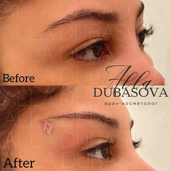 Алла Дубасова , Москва Фото - 5