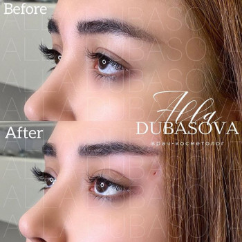 Алла Дубасова , Москва Фото - 7