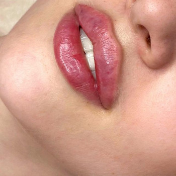 Расита Хапачева , Moscow Фото - 5