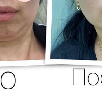 Азиза , Moscow Фото - 6