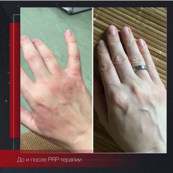 Анна Смольянова , Moscow Фото - 5