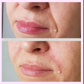 Илона Джавадян , Moscow Фото - 6