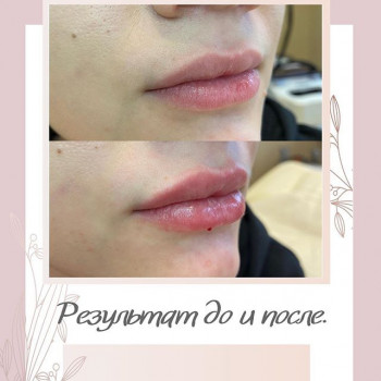 Анастасия Кучер , Moscow Фото - 6