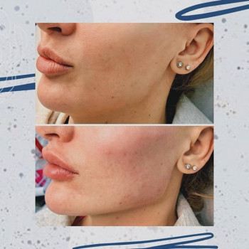 Алена Серебровская , Moscow Фото - 5