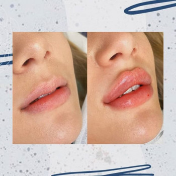 Алена Серебровская , Moscow Фото - 6