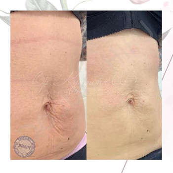 Светлана Кудрина , Moscow Фото - 5