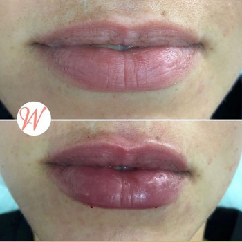 Нина Вагнер, Moscow Фото - 6