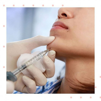 Ольга Грицевич , Moscow Фото - 6