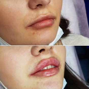 Анжела Серкилова , Moscow Фото - 5