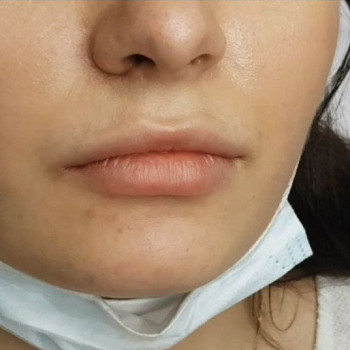 Анжела Серкилова , Moscow Фото - 6