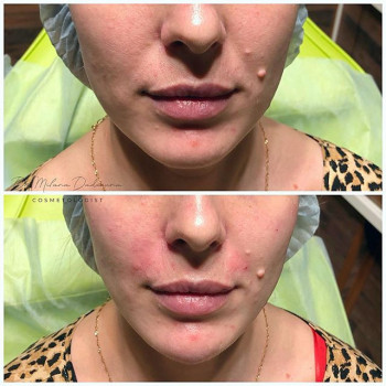 Милана Дадаева , Moscow Фото - 5