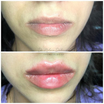 Милана Дадаева , Moscow Фото - 6