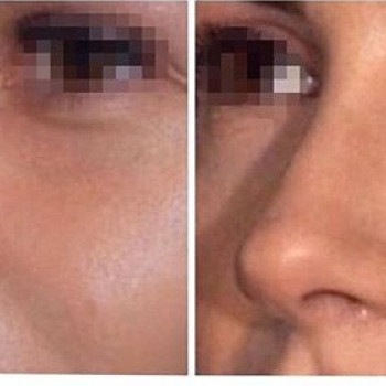 Зураб Меладзе , Moscow Фото - 6