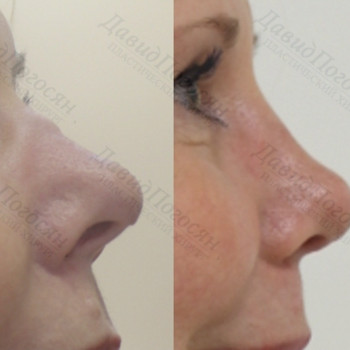 Давид Погосян , Москва Фото - 5