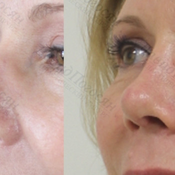 Давид Погосян , Москва Фото - 6