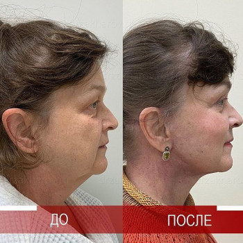 Антон Захаров , Moscow Фото - 6