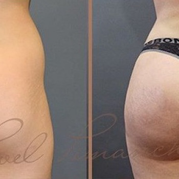 Павел Пиманчев , Moscow Фото - 6