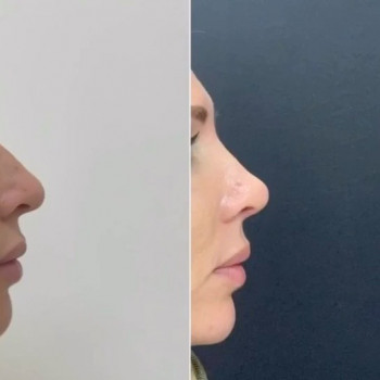 Дмитрий Скворцов , Москва Фото - 5