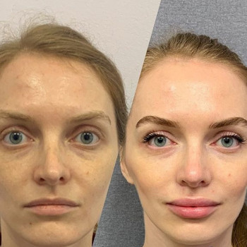 Ашот Матевосян , Москва Фото - 6