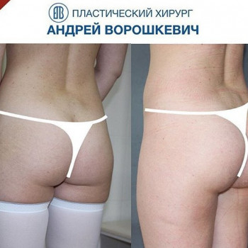 Андрей Ворошкевич , Moscow Фото - 5