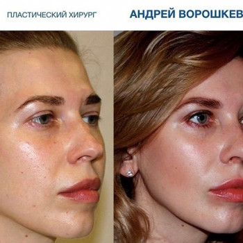 Андрей Ворошкевич , Moscow Фото - 6