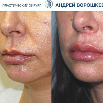 Андрей Ворошкевич , Moscow Фото - 7