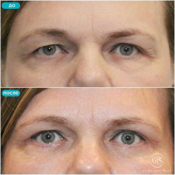 Павел Голованев , Moscow Фото - 5