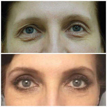 Ваагн Азизян, Москва Фото - 6