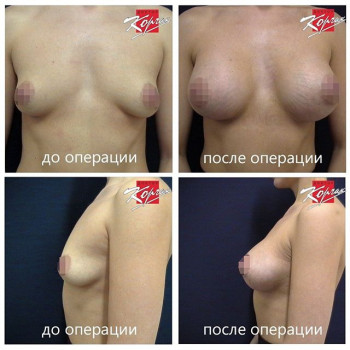 Владимир Корчак , Москва Фото - 6