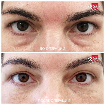 Владимир Корчак , Москва Фото - 7