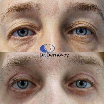 Сергей Дерновой , Moscow Фото - 5