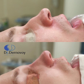 Сергей Дерновой , Moscow Фото - 6