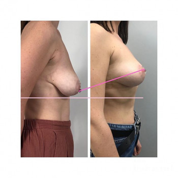 Влада Гладышева , Moscow Фото - 5