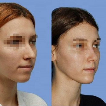 Соломон Абрамян, Moscow Фото - 5