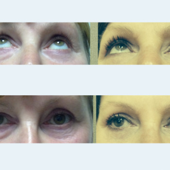 Ксения Гилева , Moscow Фото - 5