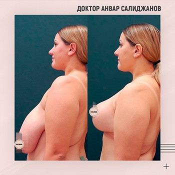 Анвар Салиджанов , Moscow Фото - 5