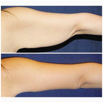 Александр Иманилов , Moscow Фото - 5