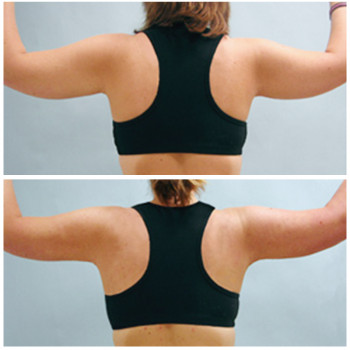 Александр Иманилов , Moscow Фото - 6