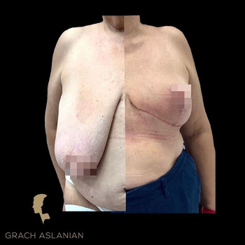 Асланян Грача , Moscow Фото - 5