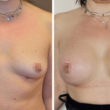 Петр Мамонтов , Moscow Фото - 5