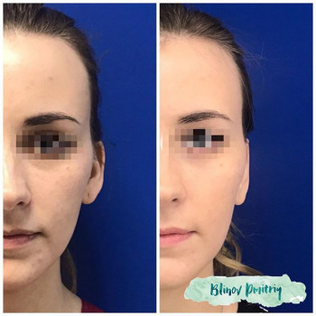 Дмитрий Блинов , Moscow Фото - 5